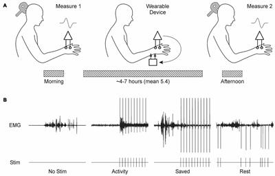 Plastic Changes in Human Motor Cortical Output Induced by Random but not Closed-Loop Peripheral Stimulation: the Curse of Causality